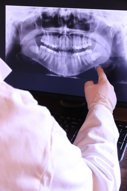 Best Emergency Wisdom Tooth Extraction in Miles, TX